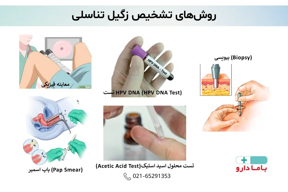 روش_های تشخیص زگیل تناسلی
